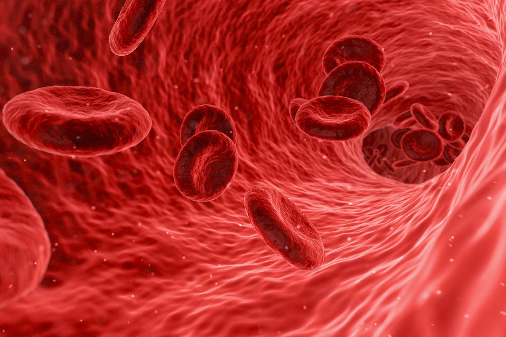 anemija